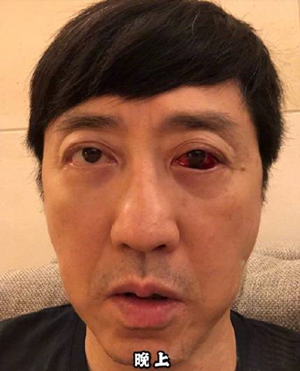 防護(hù)眼鏡