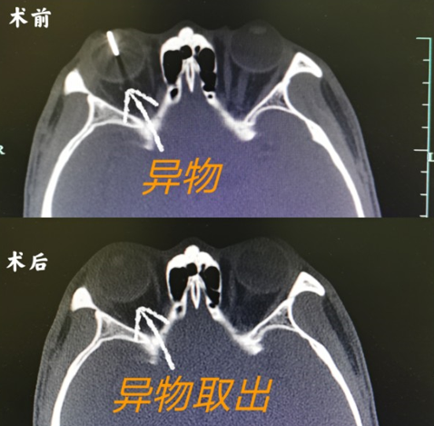 防護眼鏡