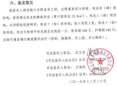 護(hù)目鏡