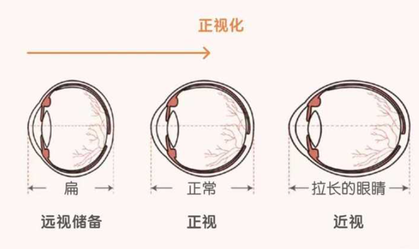 遠(yuǎn)視儲(chǔ)備