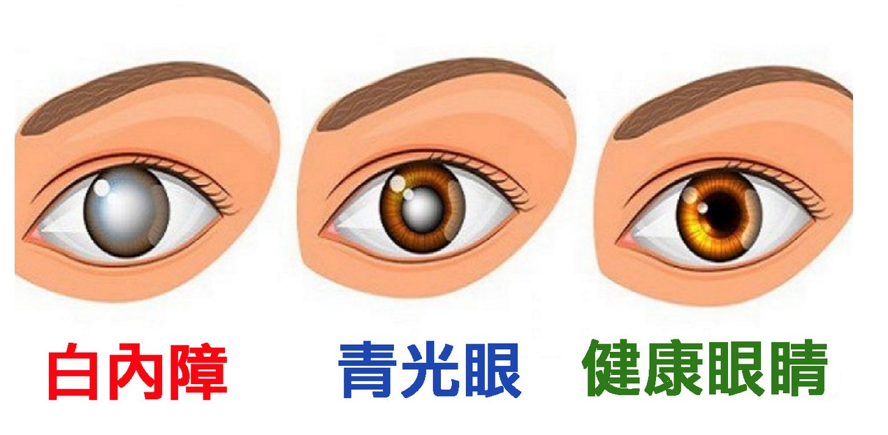 太陽鏡久戴易傷害眼睛.jpg