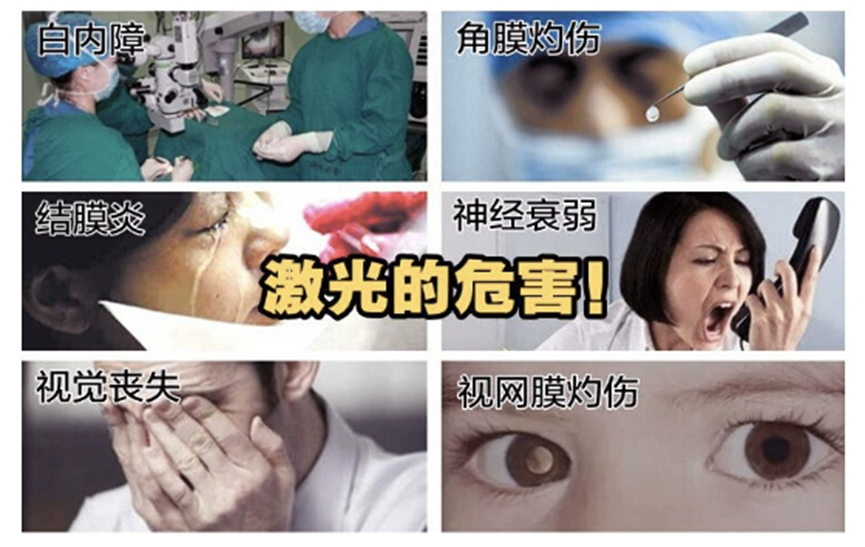 激光傷害眼睛